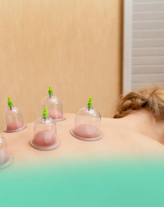 Ventosa Terapêutica